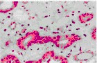 Masson trichrome stain