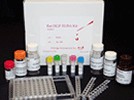 Rat substance P receptor,SP-R ELISA Kit