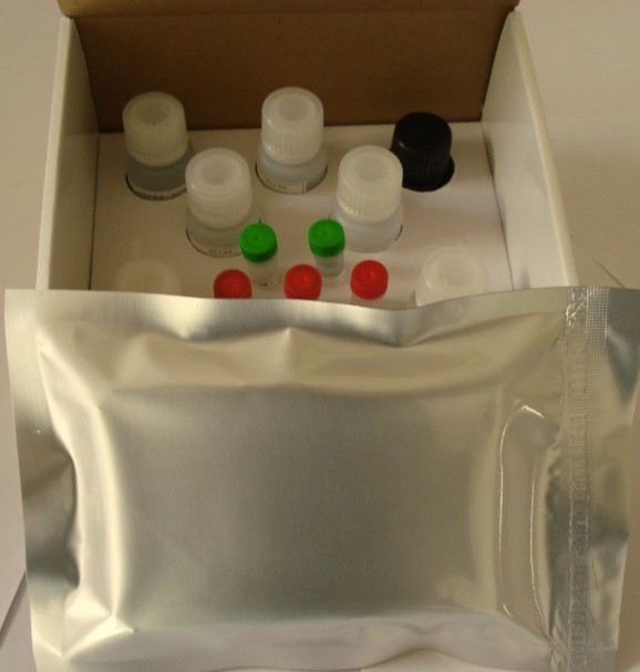 Rat Glycogen phosphorylase II,GP-II ELISA Kit