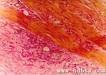 VG stain collagen fibers