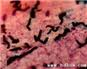 Cryptococcus neoformans mold dye