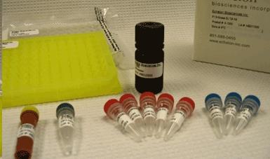 Rat Interleukin 1β,IL-1β ELISA Kit