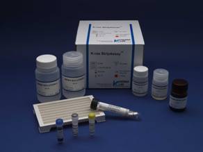 Rat Vasoactive Intestinal Peptide,VIP ELISA Kit