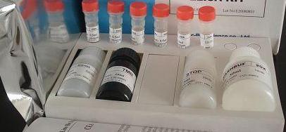 Rat Perinuclear anti-neutrophil cytoplasmic antibody,pANCA ELISA Kit