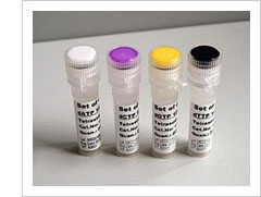 Rat Histone Deacetylase,HD ELISA Kit