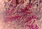Helicobacter pylori-color dye