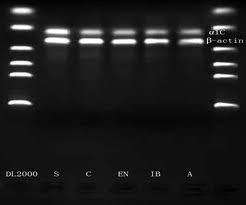 DL2000 DNA Marker